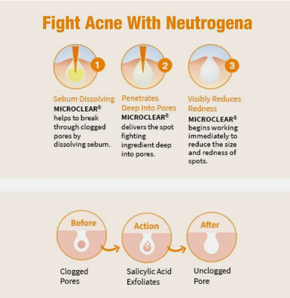 Neutrogena Oil Free Acne Wash For Acne Prone Skin With Salicylic Acid, 175ml-USA IMPORT