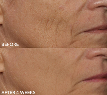 Dr. Dennis Gross DRx SpectraLite FaceWare Pro